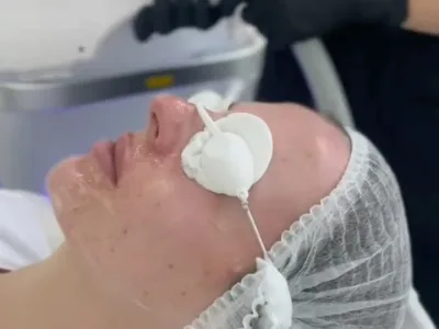 Косметолог “Вікторія Ільчишин” Львів — Косметологія у Львові, фото 1