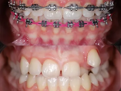Стоматологічна клініка Namnyak Dental Office — Дитяча стоматологія у Верхньому Водяному, фото 5