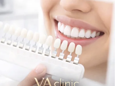 Стоматологія “Va Clinic” Хмельницький — Стоматології у Хмельницькому, фото 1